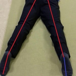chinese tcm shiatsu therapy 05