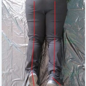 chinese tcm shiatsu therapy 13