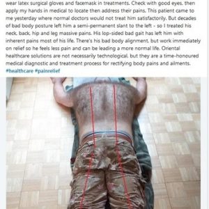 chinese tcm shiatsu therapy 15