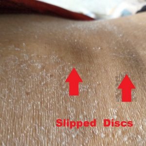 chinese tcm shiatsu therapy 16