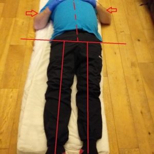 chinese tcm shiatsu therapy 19