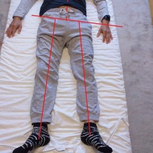chinese tcm shiatsu therapy 20