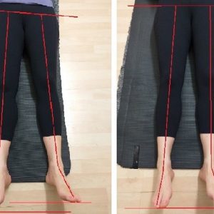 chinese tcm shiatsu therapy 24