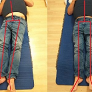 chinese tcm shiatsu therapy 26