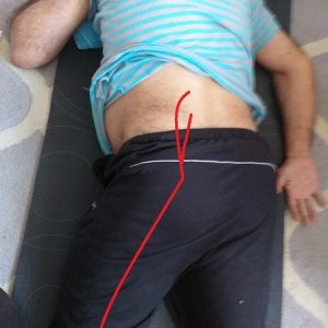 chinese tcm shiatsu therapy 31